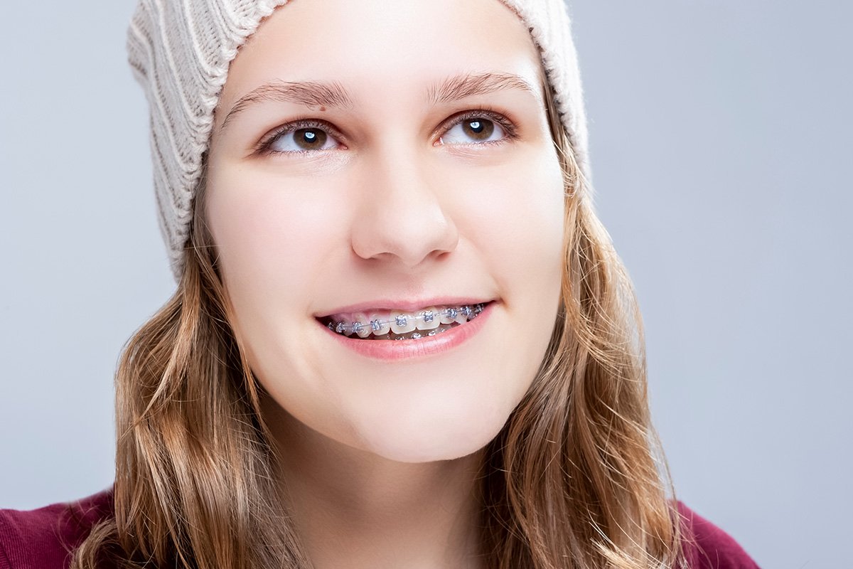 Loose Wires and Bands image